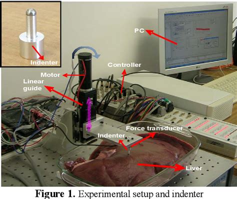 soft tissue characterization